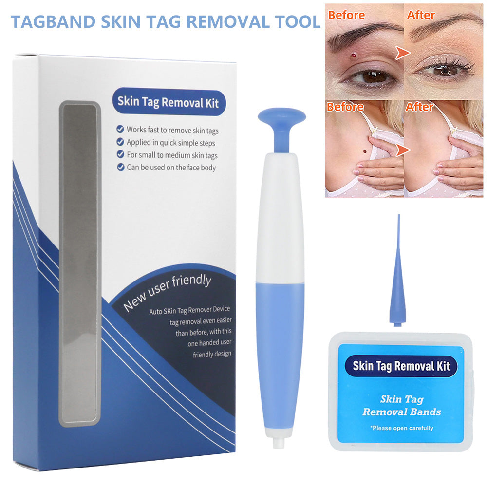 Skin Tag Removal Kit Home Use Mole Wart Remover Micro Band Skin Tag Treatment Tool Easy To Clean Skin Care Tool - Beauty & Skincare | TARVIX Skin Tag Removal Kit Home Use Mole Wart Remover Micro Band Skin Tag Treatment Tool Easy To Clean Skin Care Tool