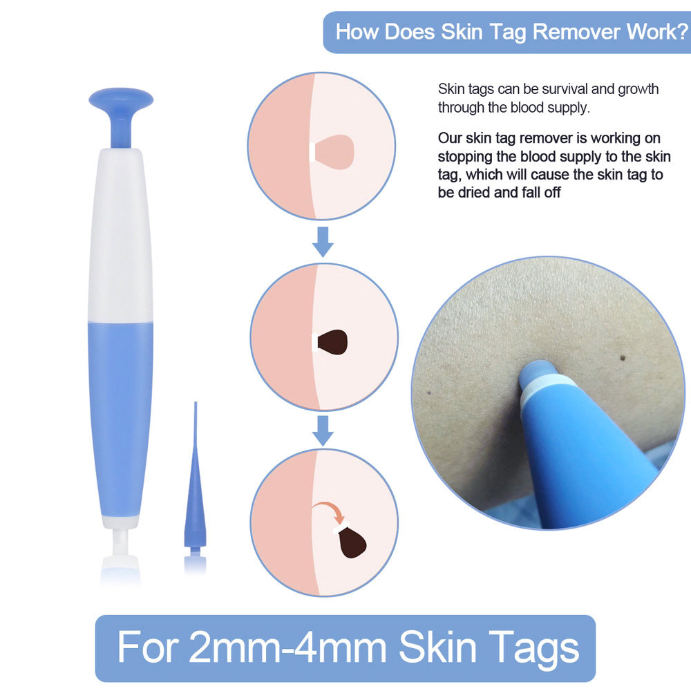 Skin Tag Removal Kit Home Use Mole Wart Remover Micro Band Skin Tag Treatment Tool Easy To Clean Skin Care Tool - Beauty & Skincare | TARVIX Skin Tag Removal Kit Home Use Mole Wart Remover Micro Band Skin Tag Treatment Tool Easy To Clean Skin Care Tool