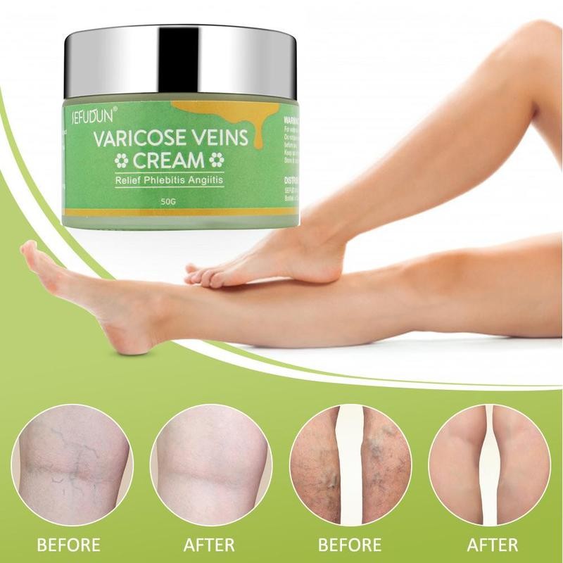 Varicose Vein Relief Cream - Beauty & Skincare | TARVIX Varicose Vein Relief Cream